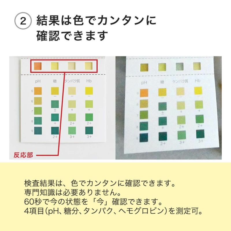 尿検査キットおしっことるよの結果は色でカンタンに確認できます